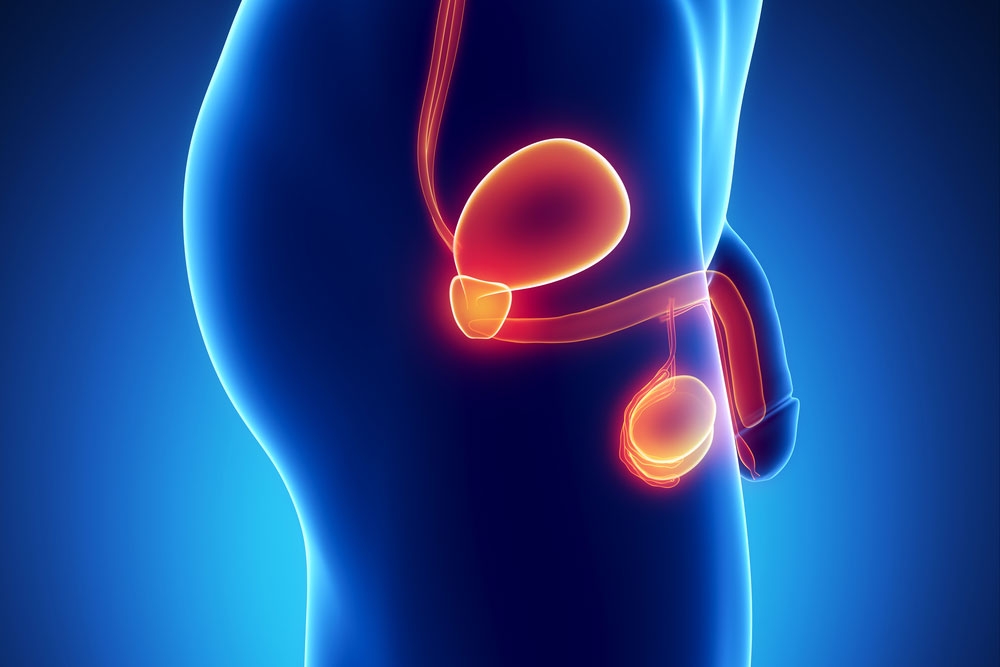 problemi di erezione dovuti al cancro alla prostata