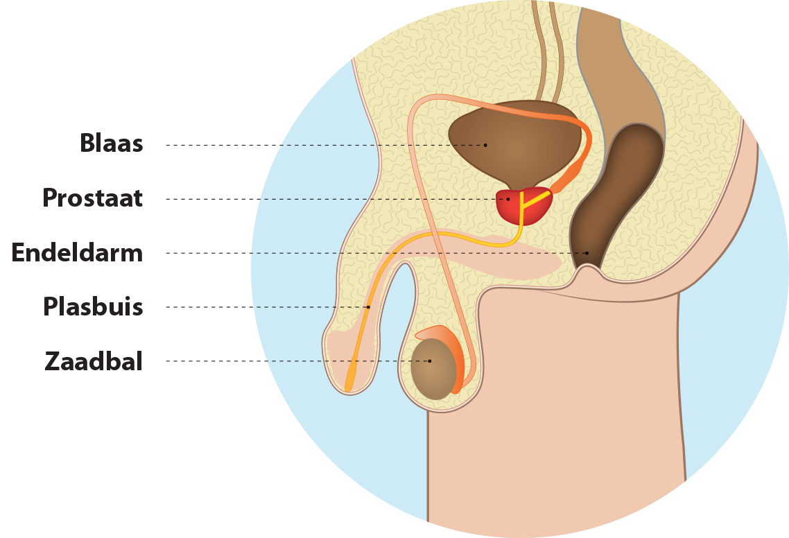 problemi di erezione dovuti alla prostata ingrossata